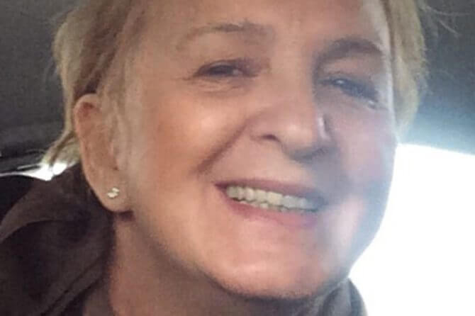 Modell av ett tandimplant